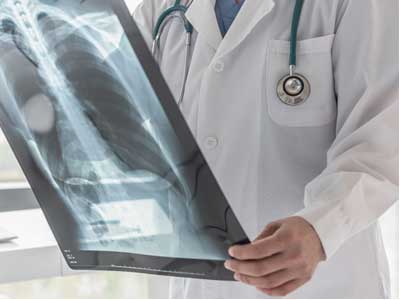 COPD & Exacerbations managed by Woodrome Medical, PA | Livingston, TX